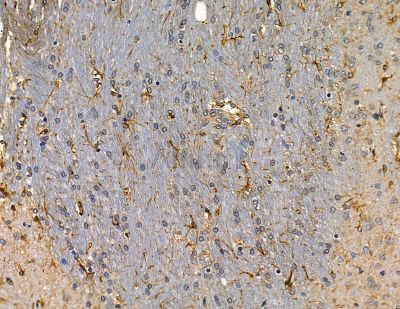 CUEDC2 Antibody - DF14080 at 1/100 staining rat brain tissue by IHC-P.