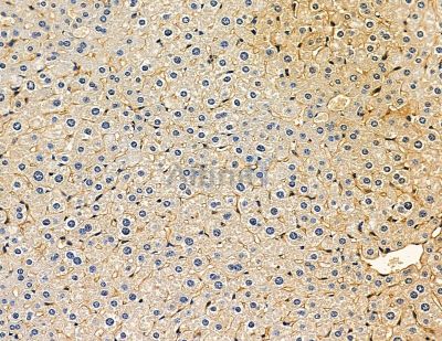 Dact2 Antibody - DF14081 at 1/100 staining mouse liver tissue by IHC-P.