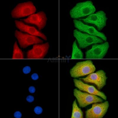 SLC37A4 Antibody - DF14085 staining Hela cells by IF/ICC.