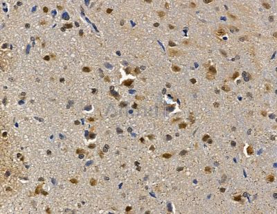 ZNF312B Antibody - DF14087 at 1/100 staining rat brain tissue by IHC-P.