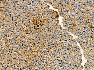 RNF139 Antibody - DF14092 at 1/100 staining mouse liver tissue by IHC-P.