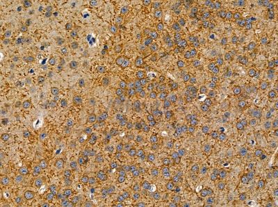 SULT2B1 Antibody - DF14095 at 1/100 staining mouse brain tissue by IHC-P.