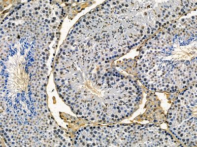 TRIM72 Antibody - DF14098 at 1/100 staining mouse testis tissue by IHC-P.
