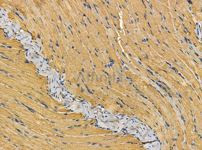 TRIM72 Antibody - DF14098 at 1/100 staining rat muscle tissue by IHC-P.
