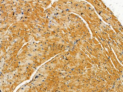 Nexilin Antibody - DF14101 at 1/100 staining mouse heart tissue by IHC-P.