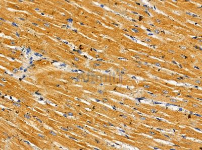 Nexilin Antibody - DF14101 at 1/100 staining rat heart tissue by IHC-P.
