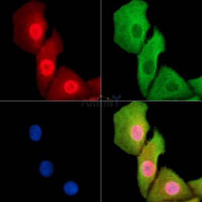 RNF43 Antibody - DF14104 staining Hela cells by IF/ICC.