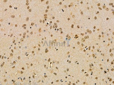 RNF43 Antibody - DF14104 at 1/100 staining rat brain tissue by IHC-P.