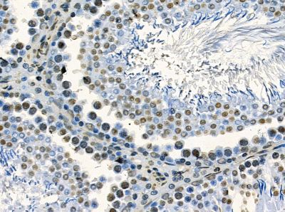 RNF43 Antibody - DF14104 at 1/100 staining rat testis tissue by IHC-P.