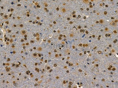 CHD3 Antibody - DF14105 at 1/100 staining mouse brain tissue by IHC-P.