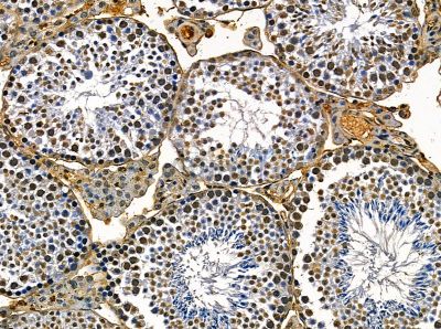 CHD3 Antibody - DF14105 at 1/100 staining mouse testis tissue by IHC-P.