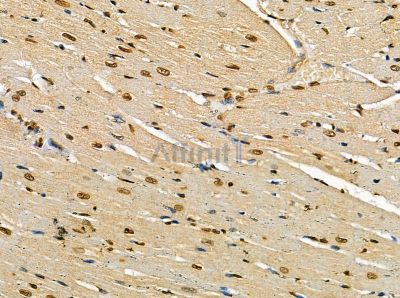 CHD3 Antibody - DF14105 at 1/100 staining rat heart tissue by IHC-P.