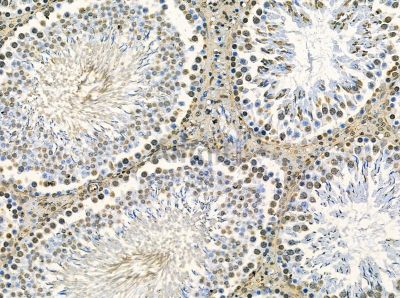 CHD3 Antibody - DF14105 at 1/100 staining rat testis tissue by IHC-P.
