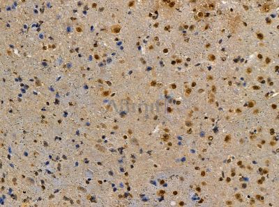 ZFR Antibody - DF14124 at 1/100 staining mouse brain tissue by IHC-P.