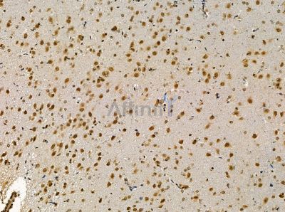 ZFR Antibody - DF14124 at 1/100 staining rat brain tissue by IHC-P.