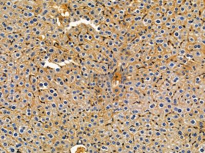 AGXT Antibody - DF14126 at 1/100 staining mouse liver tissue by IHC-P.