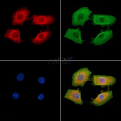 FER1L5 Antibody - DF14134 staining Hela cells by IF/ICC.