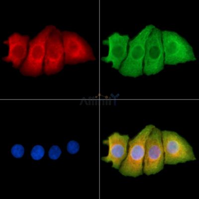 SLC12A3 Antibody - DF14140 staining Hela cells by IF/ICC.