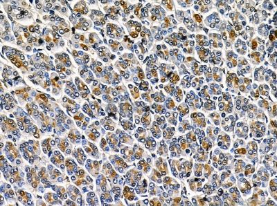 FbxL12 Antibody - DF14150 at 1/100 staining rat stomach tissue by IHC-P.
