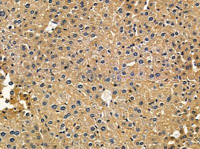 ITIH3 Antibody - DF14157 at 1/100 staining mouse liver tissue by IHC-P.