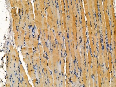CRYBA4 Antibody - DF14158 at 1/100 staining rat muscle tissue by IHC-P.