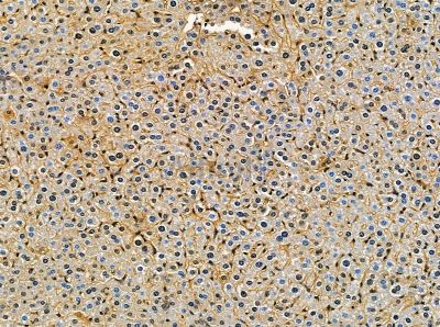 CPNE3 Antibody - DF14164 at 1/100 staining mouse liver tissue by IHC-P.