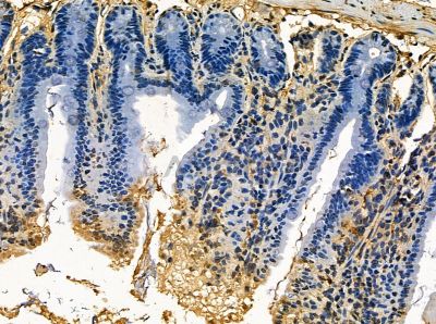 FAM62B Antibody - DF14165 at 1/100 staining mouse colorectal tissue by IHC-P.