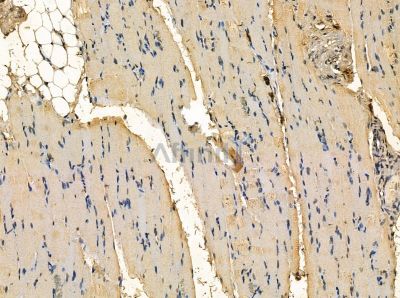 FAM62B Antibody - DF14165 at 1/100 staining rat muscle tissue by IHC-P.