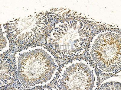 TMEM2 Antibody - DF14167 at 1/100 staining rat testis tissue by IHC-P.