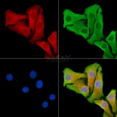 SNX33 Antibody - DF14186 staining Hela cells by IF/ICC.