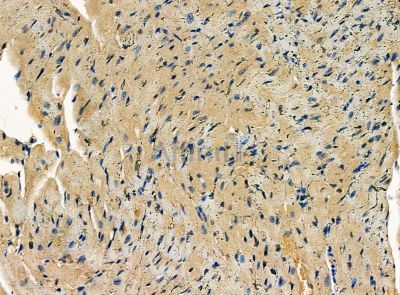 SNX33 Antibody - DF14186 at 1/100 staining mouse heart tissue by IHC-P.