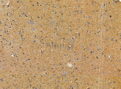 CDH20 Antibody - DF14190 at 1/100 staining rat brain tissue by IHC-P.