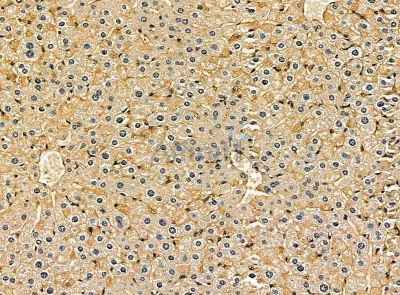 HAUS4 Antibody - DF14193 at 1/100 staining mouse liver tissue by IHC-P.