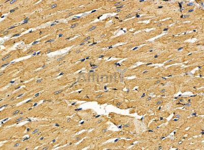 HAUS4 Antibody - DF14193 at 1/100 staining rat heart tissue by IHC-P.