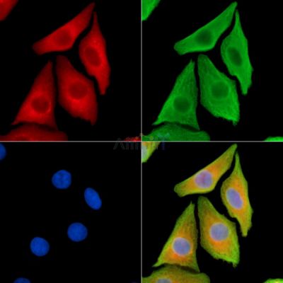 alpha COP I Antibody - DF14201 staining Hela cells by IF/ICC.