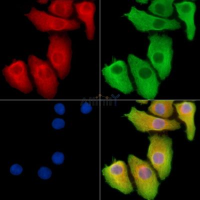 KPNA6 Antibody - DF14206 staining Hela cells by IF/ICC.