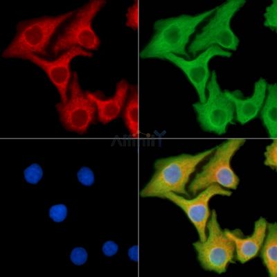 PLAC1 Antibody - DF14209 staining Hela cells by IF/ICC.