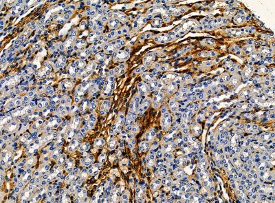 PLAC1 Antibody - DF14209 at 1/100 staining mouse kidney tissue by IHC-P.