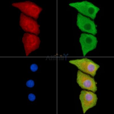 KCTD15 Antibody - DF14216 staining Hela cells by IF/ICC.