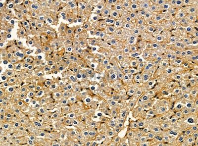 MATN3 Antibody - DF14218 at 1/100 staining mouse liver tissue by IHC-P.