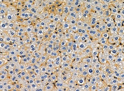 SCARA5 Antibody - DF14221 at 1/100 staining mouse liver tissue by IHC-P.