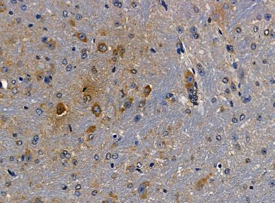 C12orf29 Antibody - DF14227 at 1/100 staining mouse brain tissue by IHC-P.