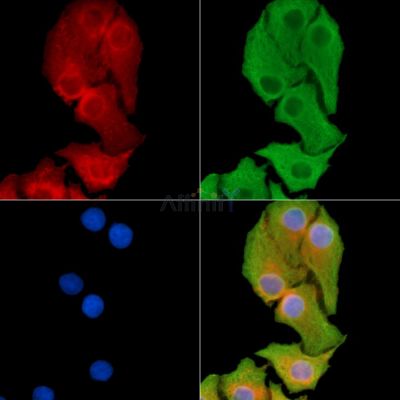 CLEC12A Antibody - DF14229 staining Hela cells by IF/ICC.