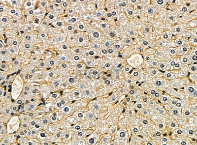 CLEC12A Antibody - DF14229 at 1/100 staining mouse liver tissue by IHC-P.