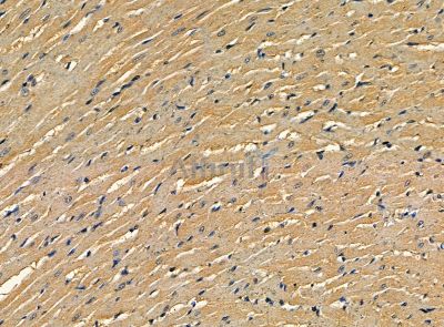 Melanoma Inhibitory Activity Antibody - DF14235 at 1/100 staining rat heart tissue by IHC-P.