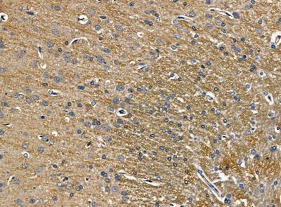 Lgi3 Antibody - DF14245 at 1/100 staining rat brain tissue by IHC-P.
