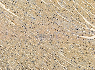 KMT2G/hSET1B Antibody - DF14246 at 1/100 staining rat heart tissue by IHC-P.