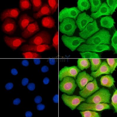 YY2 Antibody - DF14249 staining Hela cells by IF/ICC.