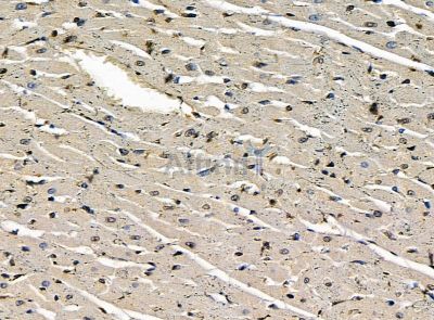 THAP7 Antibody - DF14255 at 1/100 staining rat heart tissue by IHC-P.