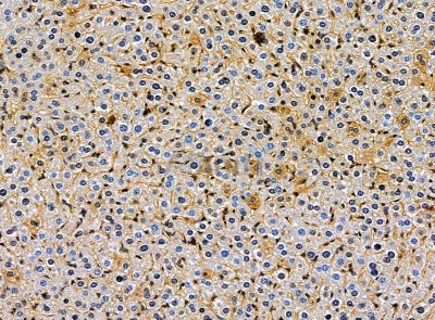LNP Antibody - DF14257 at 1/100 staining mouse liver tissue by IHC-P.